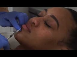 Watch Me Get Lip Injections | Real Process + Pain Tolerance 💉