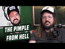 The Forehead Pimple From Hell | We're Having a Good Time | Dusty Slay Comedy