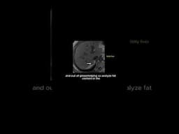 what is a axial dual echo | MRI abdomen sequence | Fatty liver #mri #mritechnologist