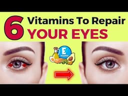Top 6 Vitamins For Your EYES HEALTH | Repair and Heal Your Eyes | VisitJoy