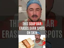 This CRAZY Soap Gets Rid Of Dark Skin Spots In Just Days!
