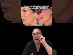 Kris Jenner’s New Face Explained