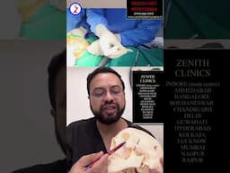 Cheek Implant surgery delhi noida gurugram Bangalore Kochi Trivendrum Bangladesh Surat India pune