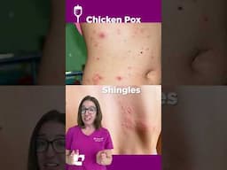 Difference between Chickenpox & Shingles: Medical Surgical SHORT | @LevelUpRN
