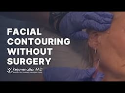 Non-Surgical Facelift with Collagen-Stimulating Threads