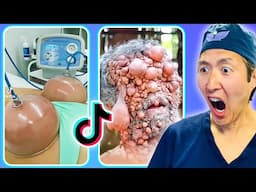 Plastic Surgeon Reacts to INSANE VIRAL TikToks Compilation