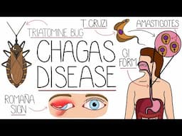 Chagas Disease Explained Clearly (American Trypanosomiasis)