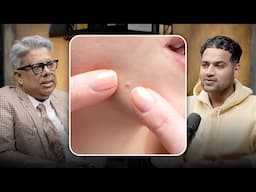 Stop Popping Pimples – Here’s What Really Happen | Raj Shamani Clips