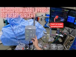 Going onto the heart-lung machine (cardiopulmonary bypass)