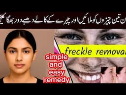 Remedy For Frackels & Dark Spots Get Fair Skin || Remove Dark Spots How To Fair Skin- Skin Glow