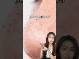 Do You Have These Skin Issues? Try This Instead😉