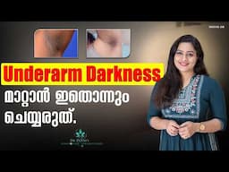 UNDERARM DARKNESS മാറ്റാൻ ഇതൊന്നും ചെയ്യരുത് How To Get Rid Of Dark Underarms | Causes| Treatment