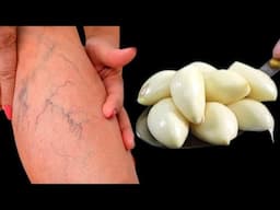 Leg pain, rheumatism, varicose veins, arthritis, headache, joint pain.
