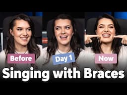 Singing with Braces: Comparing Before, Day 1, and Months Later