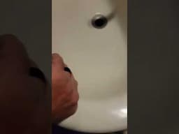 1 Minute Of Top ASMR Pimple Popping Video №94