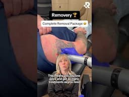 Watch this before buying tattoo removal... #removery #tattooremoval