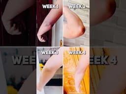 Say Good Bye to Your DARK KNEES / DARK NECK 🚨