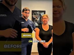 Before And After Ring Dinger® Adjustment