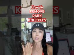 How to Remove Dark Knuckles #goseechristyhyperpigmentation