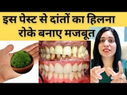 हिलते हुवे दांतों को कैसे रोके और कैसे मजबूत करे | Home Remedies For Tooth Mobility