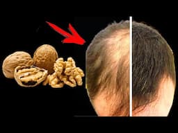Hair grows like crazy and stops falling out! The most powerful natural recipe!