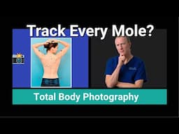 Full-Body Mole Map: How Total-Body Photography Spots Skin Cancer Early
