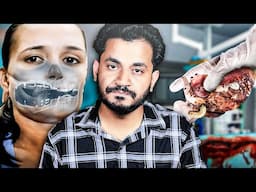 TOP 2 Worst medical BLUNDER ever (*Real Incidents*)