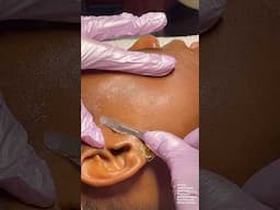 ASMR Dermaplaning