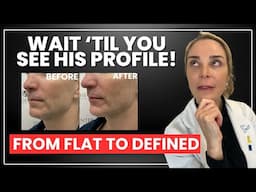 From Flat to Defined: Chin & Lip Filler Transformation for Men With Before and After Photos!