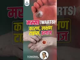 What Are Viral Warts ? Causes Symptoms and Treatment Options | Dermatologist Advice
