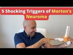 5 Surprising Causes of Morton's Neuroma You Won't Believe #3