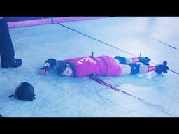 Roller Derby Disaster Ends With a Twisted Arm!