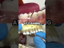 teeth cleaning dental tools explained #shorts
