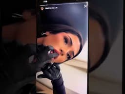 Lips