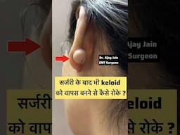 How to stop keloids forming again after successful surgery? #keloid #earpiercing