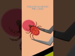 What to do if you get a tick?