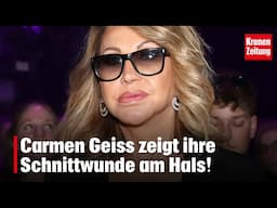Carmen Geiss zeigt ihre Schnittwunde am Hals! | krone.tv NEWS