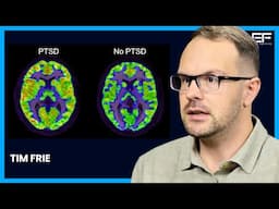 Best Diet for PTSD? Best Diet and SUPPLEMENTS After Traumatic Life Events | Timothy Frie