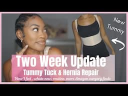 2 Week Tummy Tuck Post Op update | Umbilical￼ Hernia Repair ( diastasis recti ) W/ pics