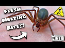 BROWN RECLUSE BITE! How DEADLY Is It REALLY?