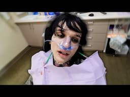 Getting my wisdom teeth removed