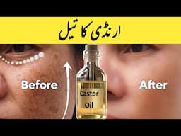 Castor Oil For Face In Urdu Hindi - Dr Irfan Azeem
