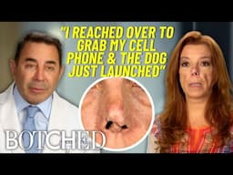 A Dog Bite Followed By An Infection Left Carolina With A Severely Deformed Nose | Botched | E!