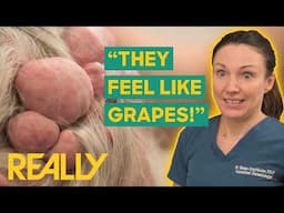Dr. Emma Removes Rare Grape-Like Skin Tumors From Man’s Head | The Bad Skin Clinic