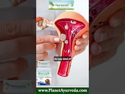 Vriddhivadhika Vati for Overgrowths - Cysts, Hernia, Fibroids, Tumors, etc? Explained by Dr. Chauhan