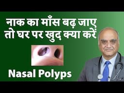 Nasal Polyps । नाक के पोलिप्स । Dr Rajive Bhatia । Hindi