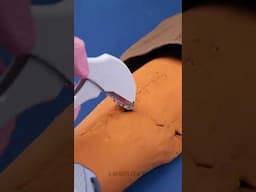 Revealing the Secrets of Body Surgery to Save Lives 💊