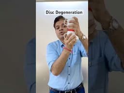 Disc Degeneration, Benefits of Degenerative Disc, #shorts #herniateddisc #physiotherapy