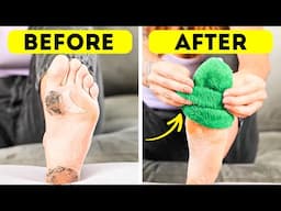 Feet Ready for Summer? Try These Easy Glow-Up Hacks! 💅👡 #footcare
