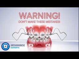 Common Mistakes During Braces Treatment: What Not To Do